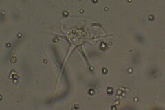 Amoebozoa