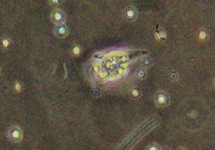 Amoebozoa