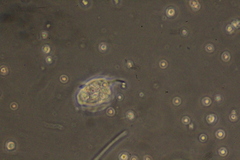 Amoebozoa
