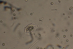 Amoebozoa