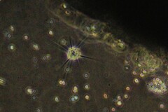 Amoebozoa