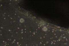 Amoebozoa