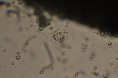Amoebozoa