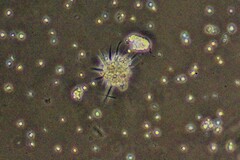 Amoebozoa