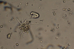 Amoebozoa