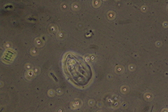 Scenedesmus