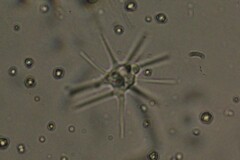 Amoebozoa