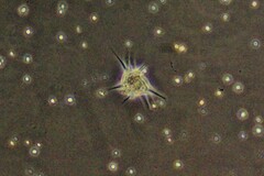 Amoebozoa