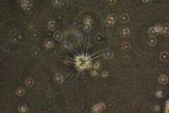 Amoebozoa