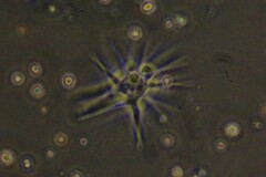 Amoebozoa