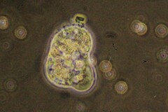 Amoebozoa
