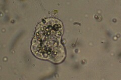 Amoebozoa