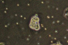 Amoebozoa