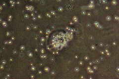 Amoebozoa