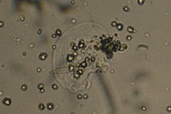 Amoebozoa