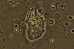 Amoebozoa
