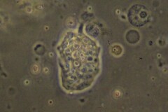 Amoebozoa