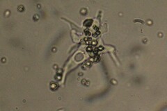 Amoebozoa