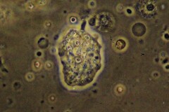 Amoebozoa