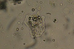 Amoebozoa