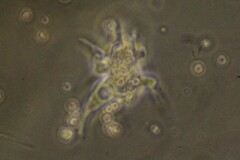 Amoebozoa