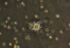 Amoebozoa