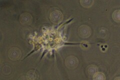 Amoebozoa