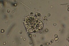 Amoebozoa