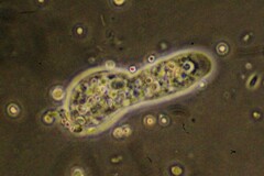 Amoebozoa