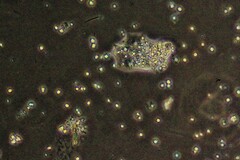 Amoebozoa