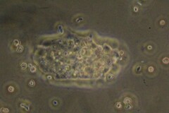 Amoebozoa
