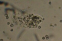 Amoebozoa