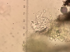 Placidiopsis hypothallina