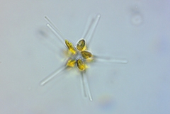 Asterionellopsis