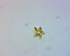 Asterionellopsis