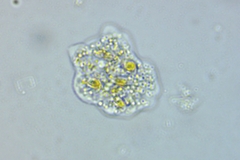 Amoebidae