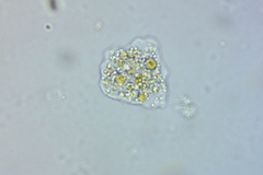 Amoebidae