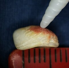 Homotrema rubrum