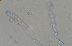 Peziza moravecii