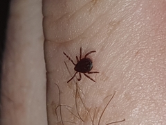 Rhipicephalus appendiculatus