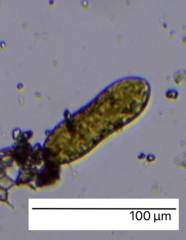 Surirella librile
