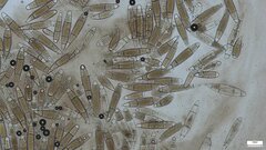 Bactridium subglandis