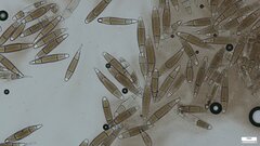 Bactridium subglandis