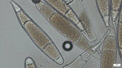 Bactridium subglandis