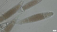 Bactridium subglandis