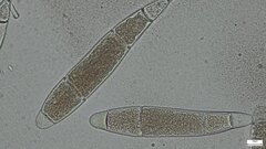 Bactridium subglandis