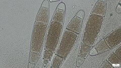 Bactridium subglandis