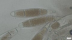 Bactridium subglandis