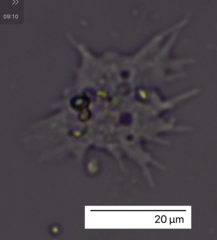 Amoebozoa