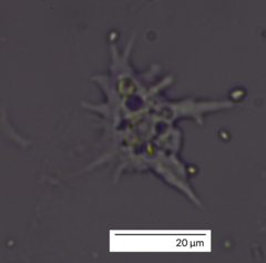 Amoebozoa